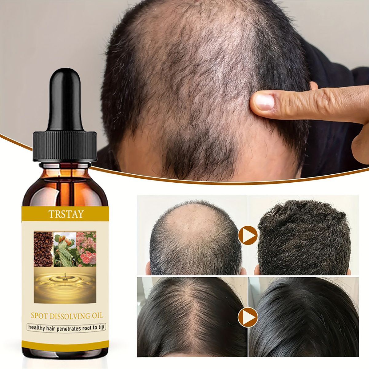 50Ml Baard Groei Olie Anti Alo - Beard Oil recensie en prijs